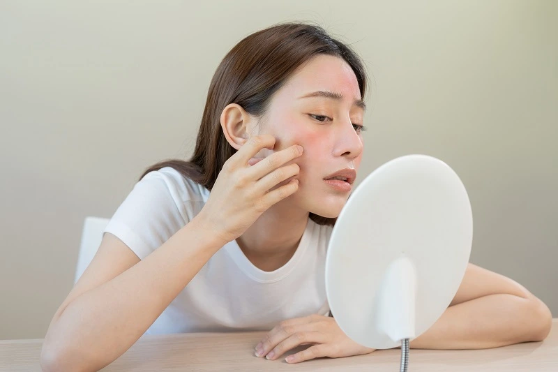 Perawatan Kulit Sensitif Terbaik: Produk, Tips, dan Rekomendasi Dokter Kulit